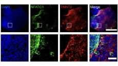 Flourescent images of the heart organoids, shown in blue, green, red and then a colorful composite ima